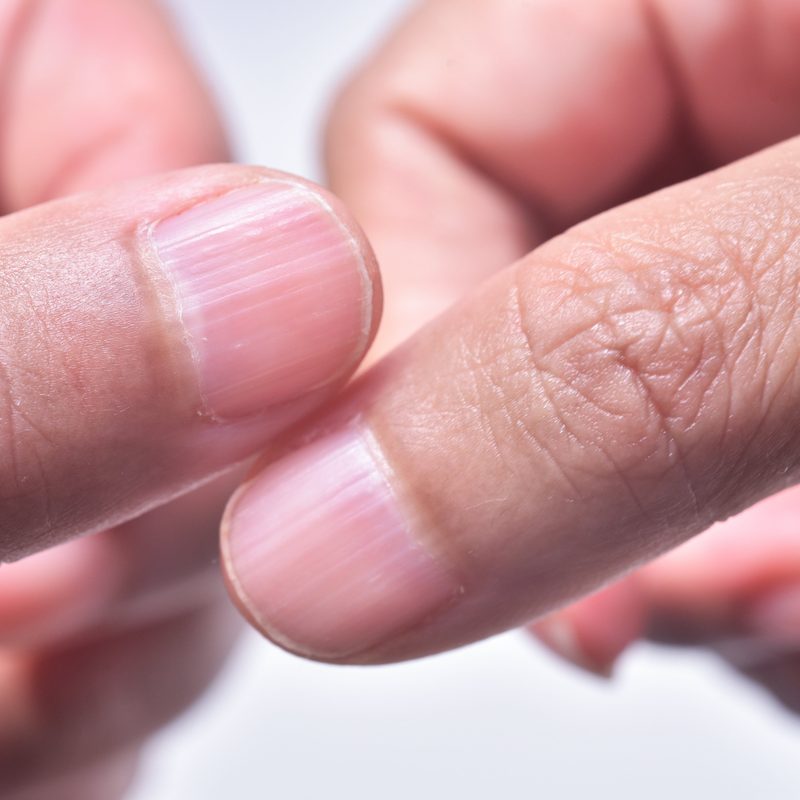 art labeling activity nail structure